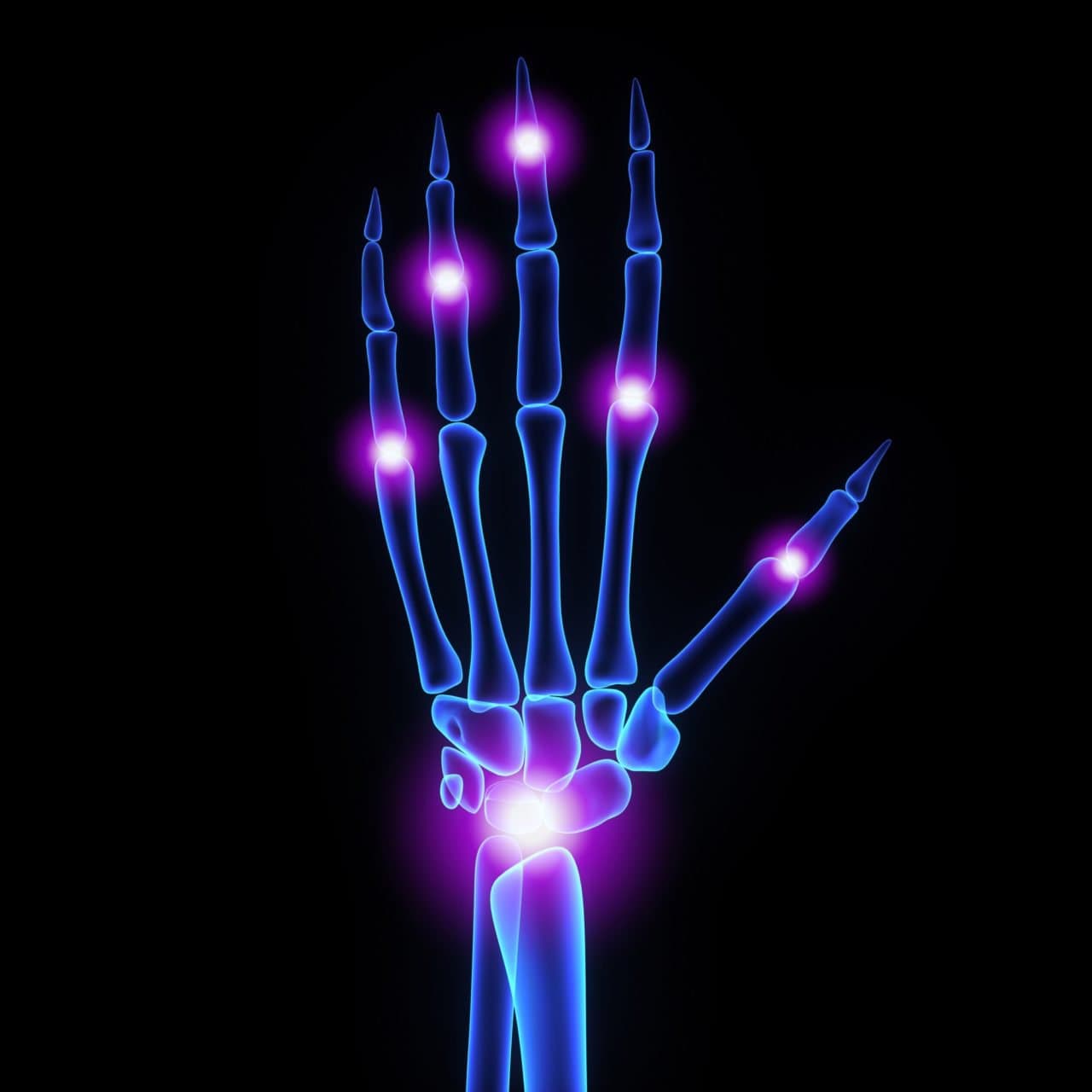 An X-ray style image of a hand and wrist with the joints highlighted.